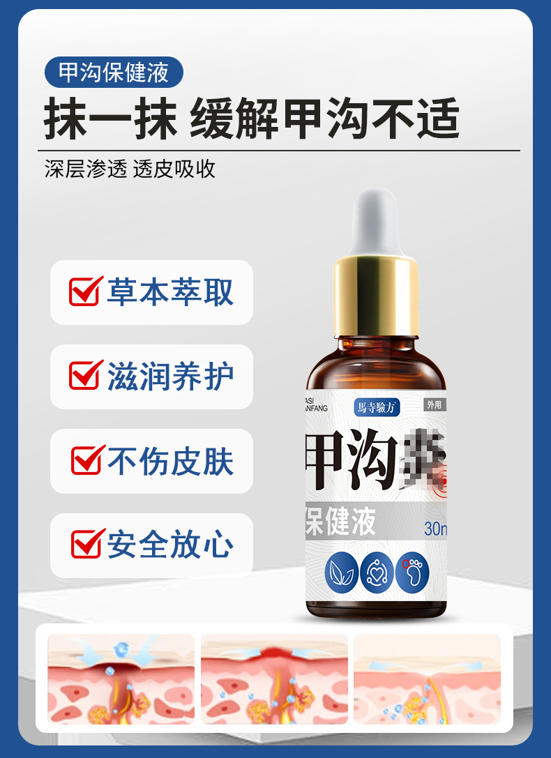 抹一抹，緩解甲溝不適